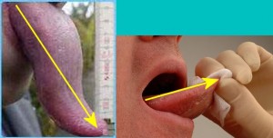 Strong_Yin_Analysis_010-TongueLengthsCompare