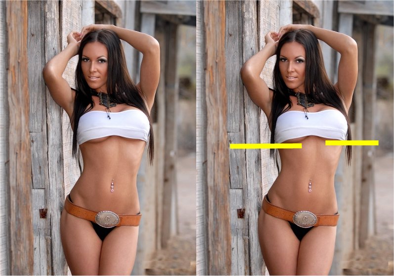 Anorexia_Dent_Analysis_10-RightBreastLower